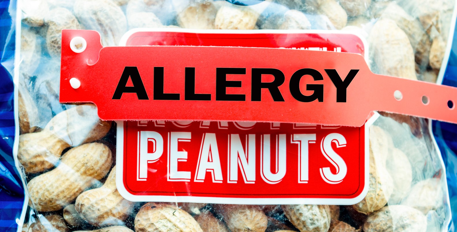Arašidy často spôsobujú potravinovú alergiu