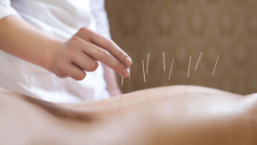 Akupunktúra pomáha pri zmiernení príznakov cukrovky