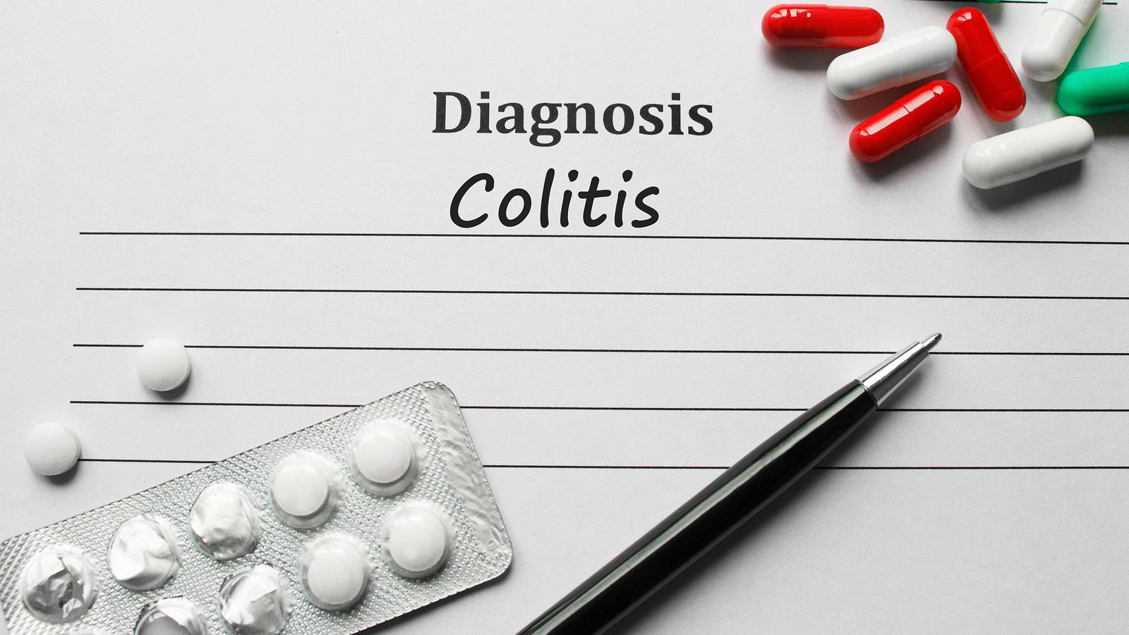 Presná príčina vzniku ochorenia ulcerózna kolitída nie je známa