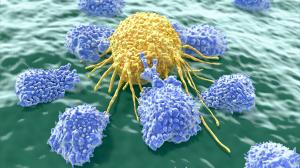 Pri liečbe pacientov s rakovinou môžu imunobunky, pochádzajúce z cudzieho organizmu, zachrániť životy