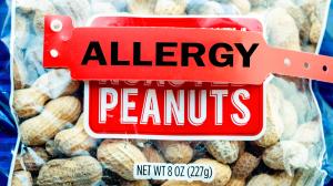 Nový spôsob liečby alergie na arašidy