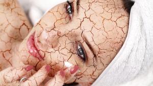 Suchá koža – Môže mať aj vnútorné príčiny
